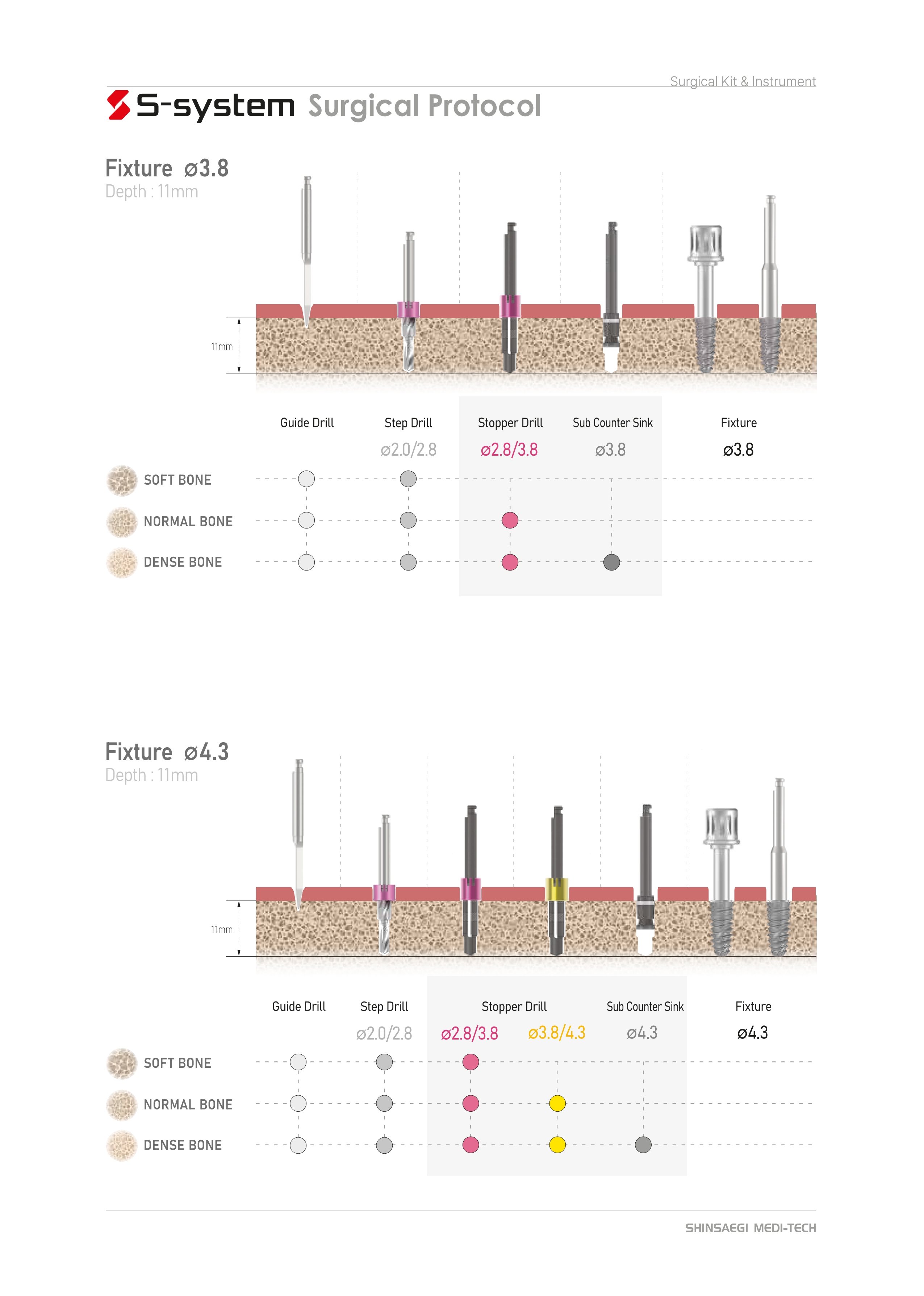 prosthesis