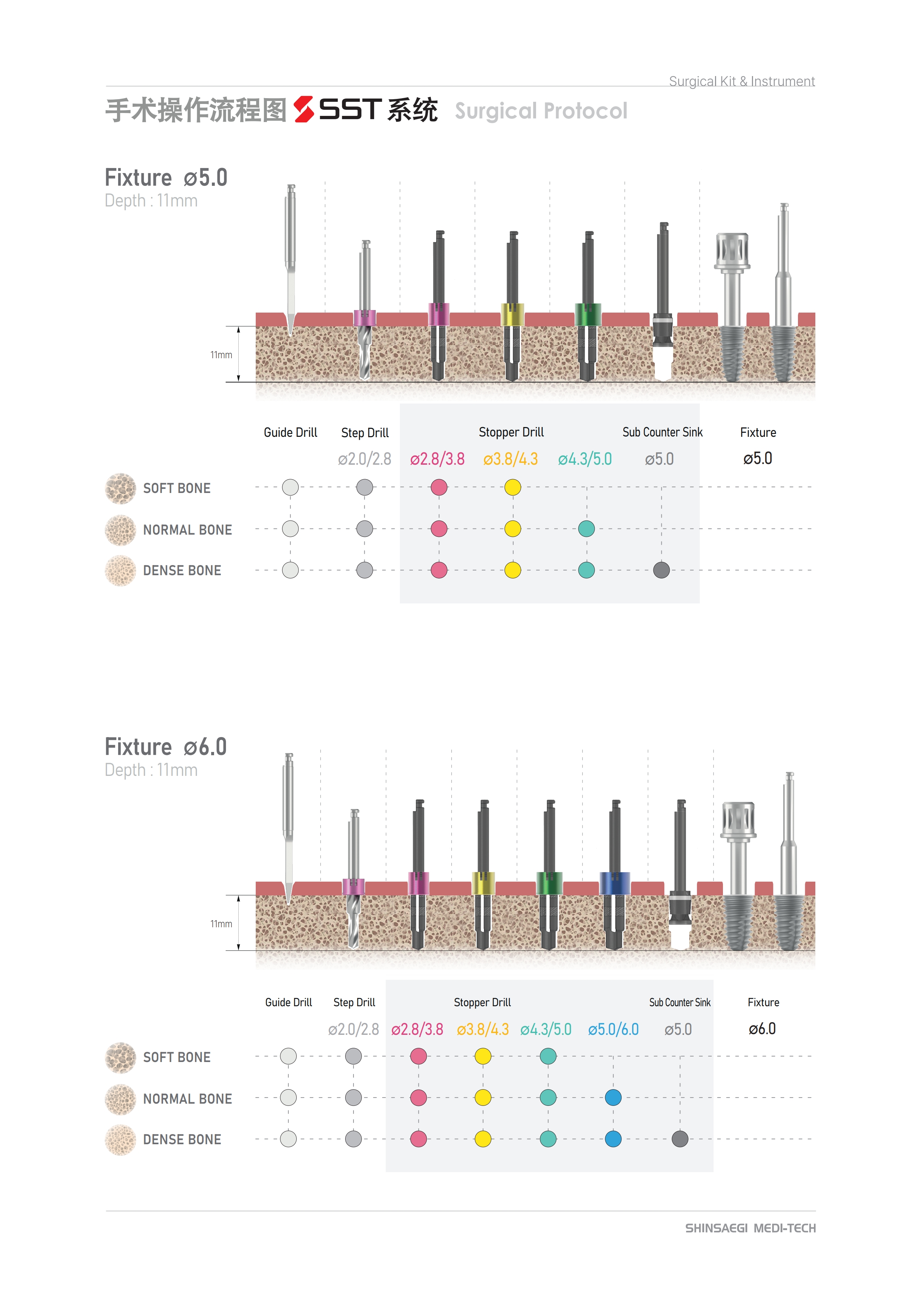 prosthesis