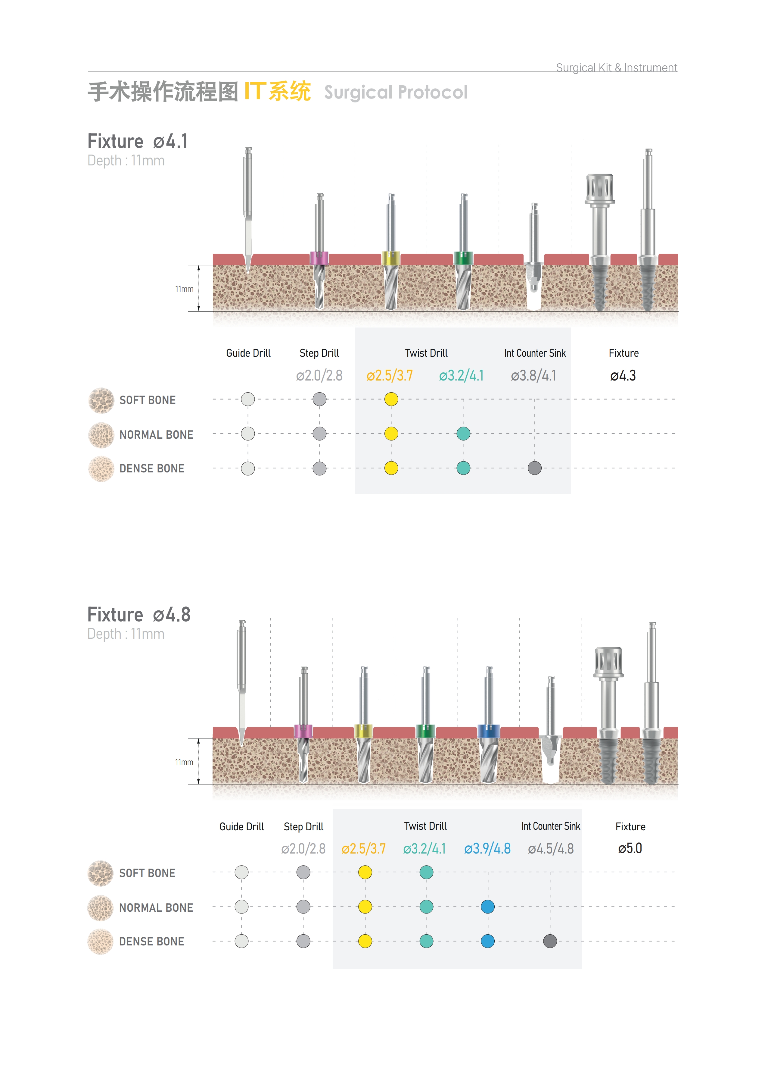 prosthesis